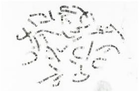 chromosome spread on slide cytogenetic test chamber